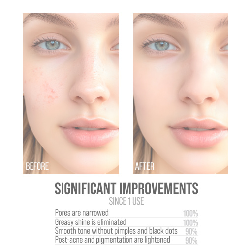 Gift set MATTIFYING PARADISE