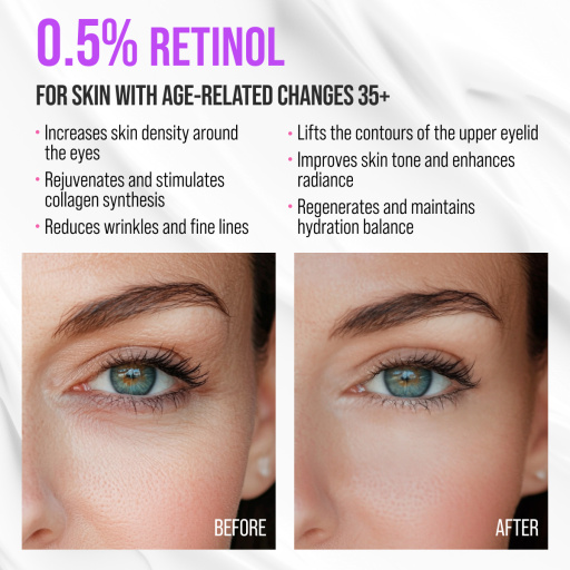 Eye cream cryo massager, anti-age and lifting, Retinol 18 ML